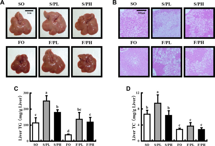 Liver morphology, histological sections, and liver lipid parameters in ...