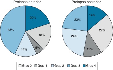 Avaliação inicial do grau de prolapso (classificação de Baden‐Walker).