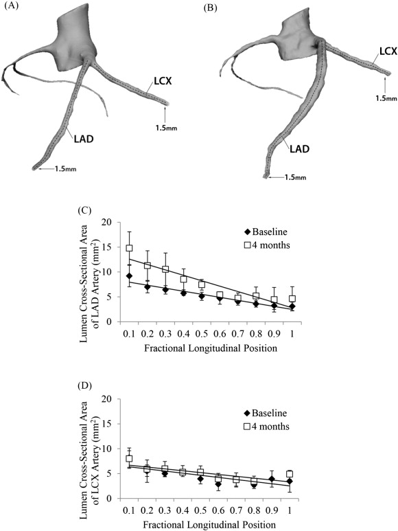 LAD and LCX trunk reconstruction with center lines from one representative ...