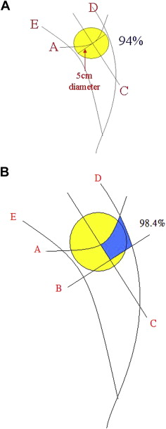 (A) Schematic diagram of the area in which 94% of SLNs are located according to ...
