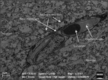 Normal neuropil-capillary relation in the sham group.