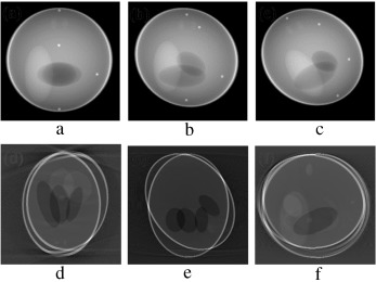 (a–c) Projection at 160°,180° and 200° source position. (d–f) Axial, coronal and ...
