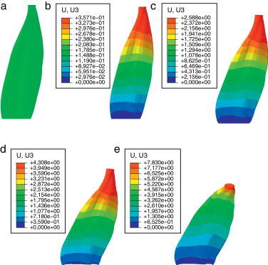 Campo de desplazamientos en la dirección longitudinal del músculo para una ...
