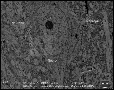 Normal neuron and neuropil in Group Id.