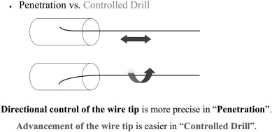 Controlled drilling vs penetration for intimal plaque tracking.