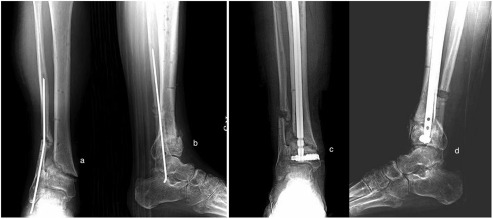 Fig. 4