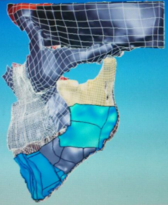 Reconstruction sagittal view.