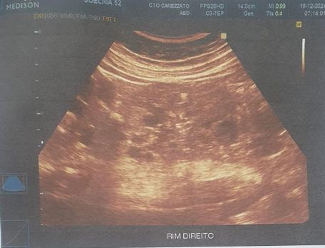 Draft Prado Junco 408440319-image4.jpeg