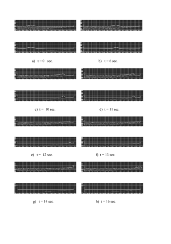Wave breaking on a beach. Comparison with analytical results at different time steps. Top: PFEM solution. Bottom: Analytical solution.