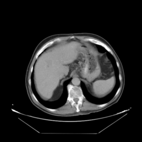 Portal venous phase (template dataset, T)