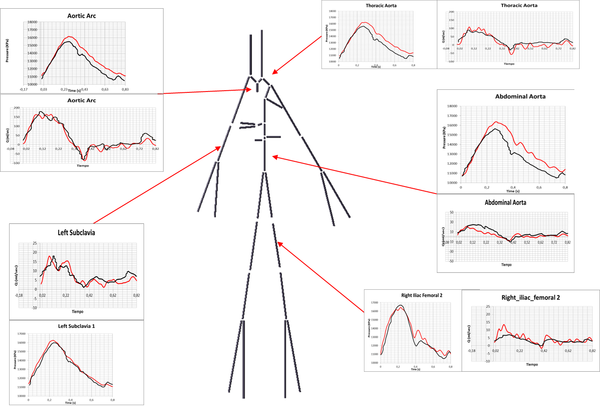Simulated physiological(blank line) versus numerical results(red line) features of pressure and flow rate in difference section of the cardiovascular system.