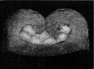 Corte transversal do terminal crimpado em experimento real - altura do terminal de 1,25/1,26 mm - largura do terminal de 2,25 mm