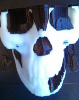 3D Model of the patient.