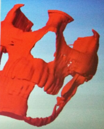 3D model reconstruction.