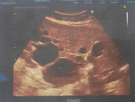 Draft Prado Junco 408440319-image2.jpeg