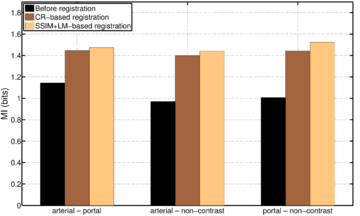 Mean similarity between images in terms of mutual information for the three considered scenarios (arterial-portal, arterial-non-contrast and portal-non-contrast) before and after the registration.