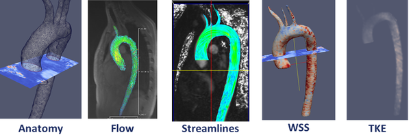 Diagnostic Indicators in a patient-specific model